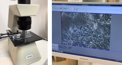 位相差顕微鏡による歯周病菌チェック